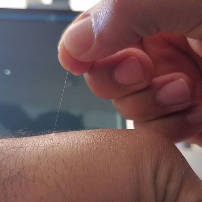 Những sợi lông này rất mỏng và gần như trùng với màu da