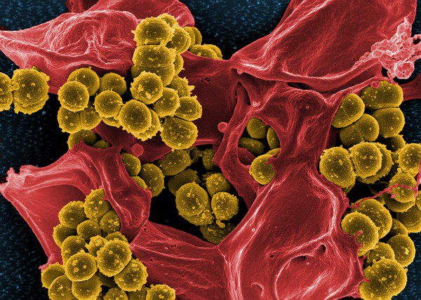 Siêu vi khuẩn MRSA Khám phá ổ vi khuẩn đang ngủ chung giường với bạn