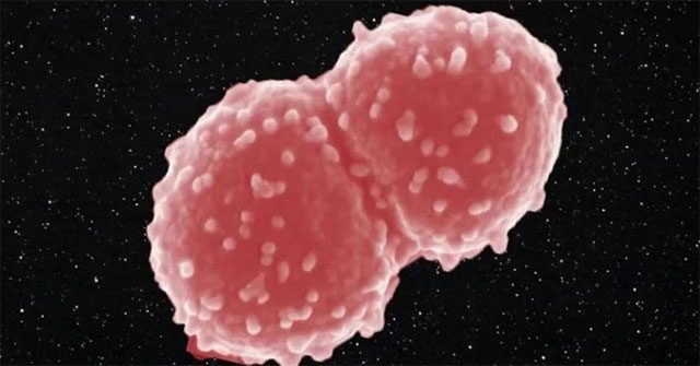 Vi khuẩn Deinococcus radiodurans, sinh vật duy nhất chịu được bức xạ cao